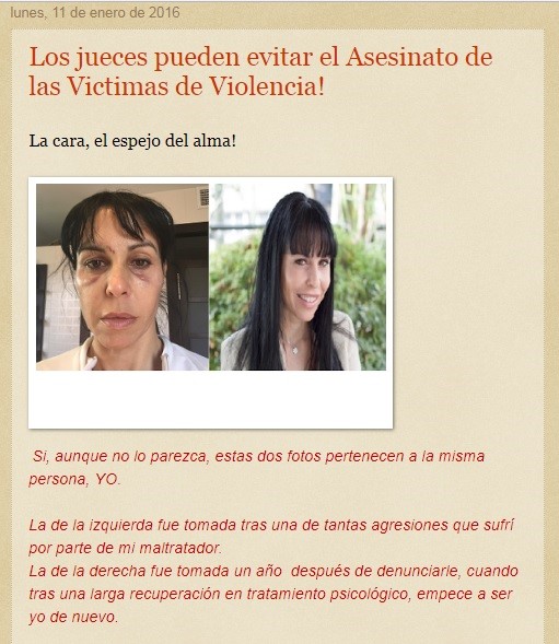 Todo sobre las histéricas mentiras de Isabel López de la Torre, la falsa heroína feminista (1): Hematomas que no son de agresiones