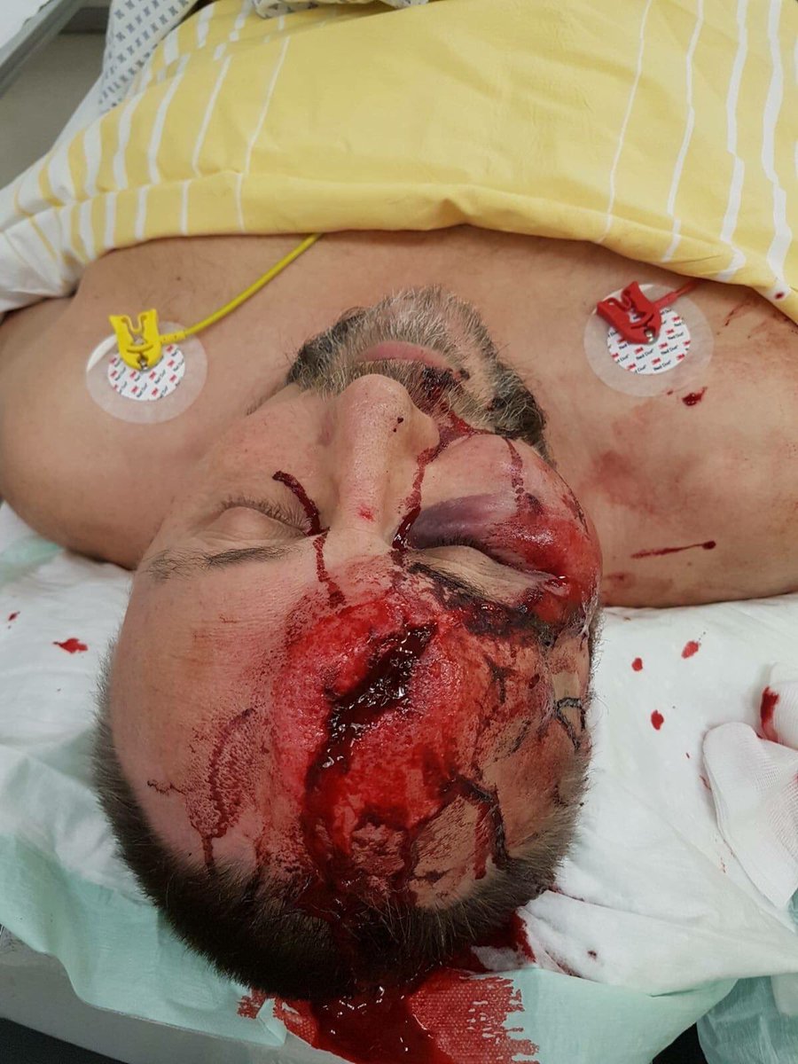 Brutal atentado contra un dirigente de Alternativa para Alemania en Bremen